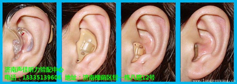 斯达克助听器哪个牌子好