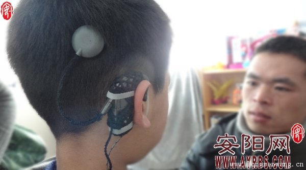 安阳:人工耳蜗助失聪儿童获新“声”