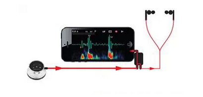 从助听听诊器看听力学技术发展-与手机连接使用