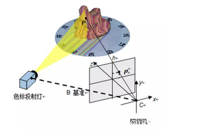 3D印模扫描